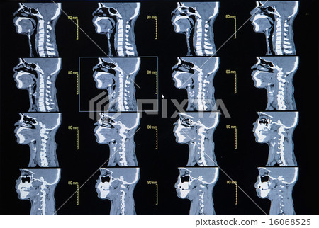images from a computerized tomography of neck 16068525