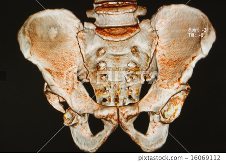 pelvis x-rays 3D image 16069112
