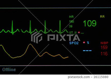 EKG monitor in ICU unit EKG monitor in ICU unit 16115080