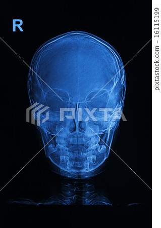 skull x-rays image skull x-rays image 16115199