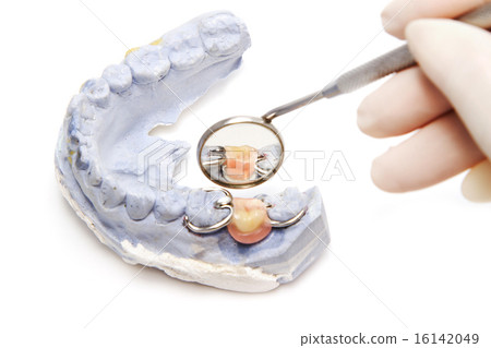 Dental prosthesis on gypsum model plaster 16142049