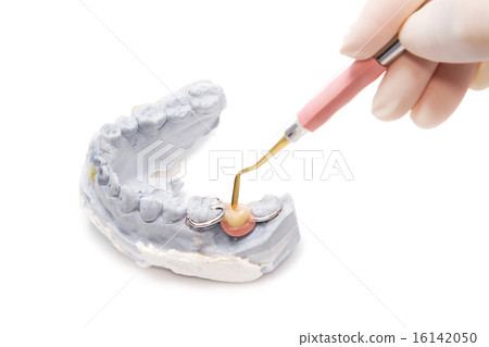 Dental prosthesis on gypsum model plaster 16142050