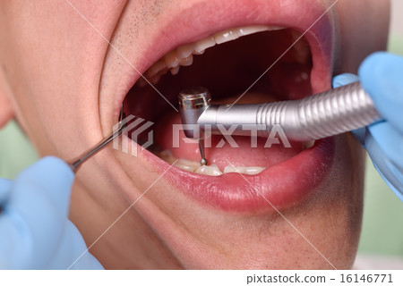 dentist using drill dentist using drill 16146771
