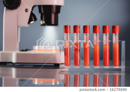Blood test in medical laboratory, check sugar con 16279890