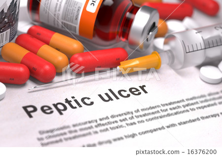 Diagnosis - Peptic Ulcer. Medical Concept. Diagnosis - Peptic Ulcer. Medical Concept. 16376200
