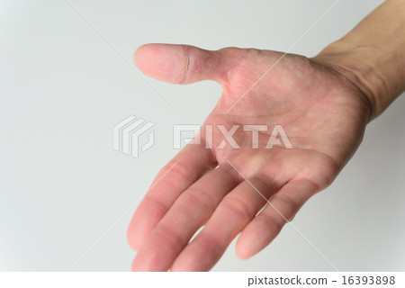 皮膚粗糙 皮膚粗糙 16393898