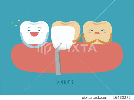 Veneers teeth of dental 16480272