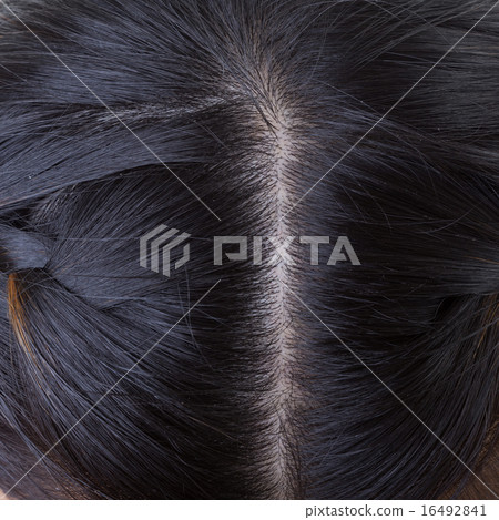 black hair with dandruff on head, close-up image black hair with dandruff on head, close-up image 16492841