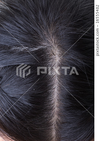 black hair with dandruff on head, close-up image 16555482
