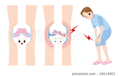 Women with joint aches Women with joint aches 16614901