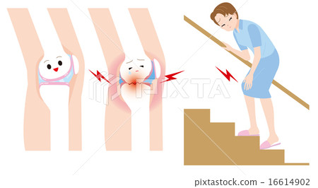 在爬樓梯時有關節疼痛的女性 16614902