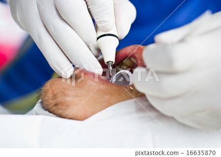 Dental Prophylaxis Dental Prophylaxis 16635870