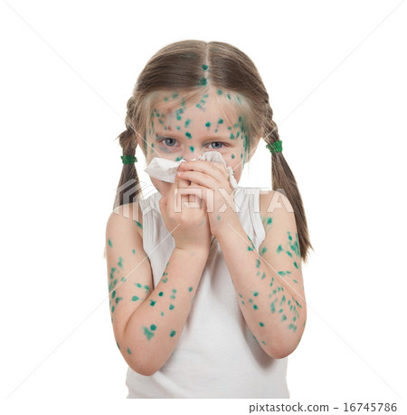 sick child. chickenpox 16745786