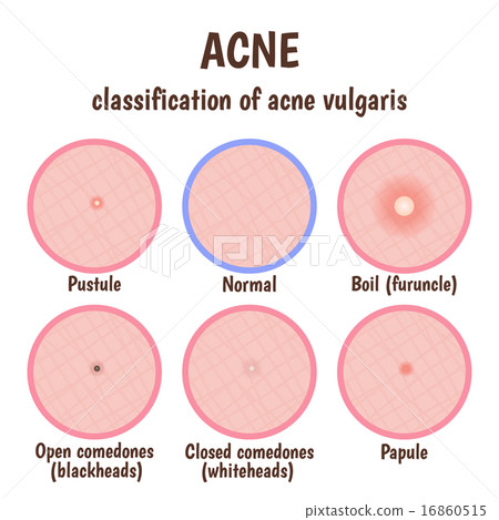 problem skin problem skin 16860515