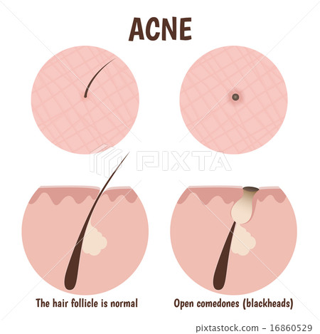 structure of the hair follicle 16860529