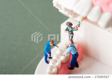 Dental model and image of the implant 17090567