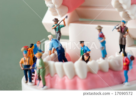 牙科模型和植入物的圖像 牙科模型和植入物的圖像 17090572