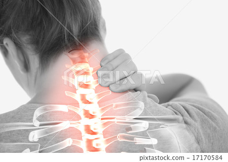 Highlighted spine of woman with neck pain Highlighted spine of woman with neck pain 17170584