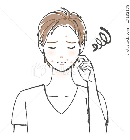 遭受粉刺的一個男性例證 17182178