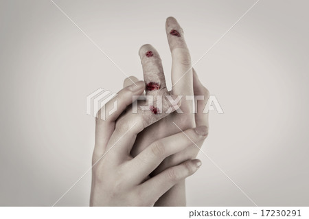 Pain_030 17230291
