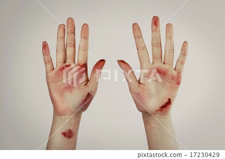 Pain_024 Pain_024 17230429