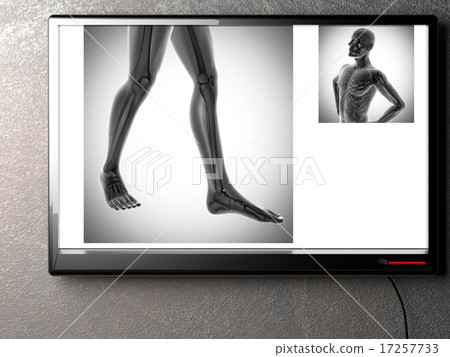 human bones radiography scan image 17257733