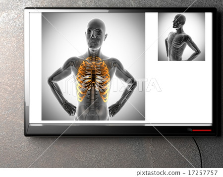 human bones radiography scan image human bones radiography scan image 17257757