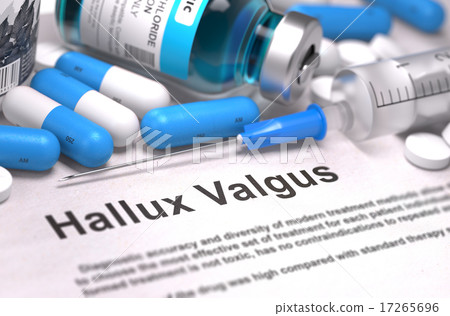 Hallux Valgus Diagnosis. Medical Concept.  17265696