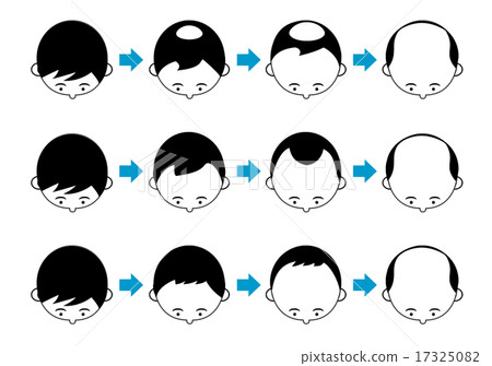 Progress type of AGA 17325082