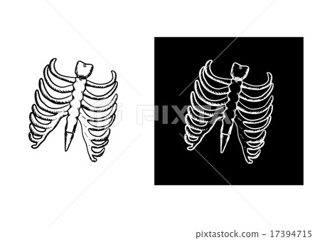 X-ray and skeleton of human rib cage X-ray and skeleton of human rib cage 17394715