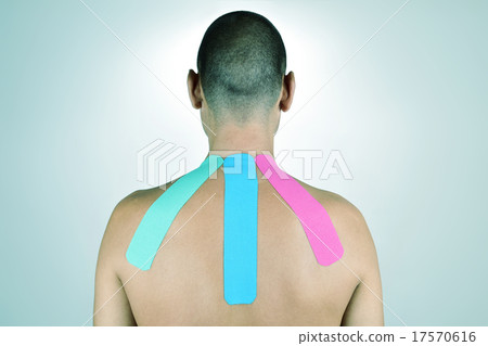 man with strips of therapeutic tape in his back man with strips of therapeutic tape in his back 17570616
