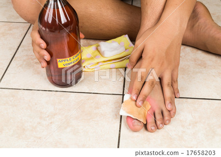 Apple cider vinegar remedy for skin itch & fungus Apple cider vinegar remedy for skin itch & fungus 17658203