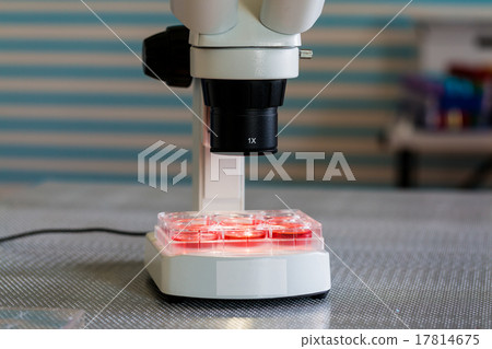blood test in medical laboratory  17814675