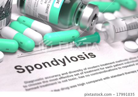 Diagnosis - Spondylosis. Medical Concept with Diagnosis - Spondylosis. Medical Concept with 17991835