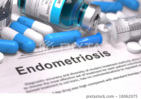 Endometriosis Diagnosis. Medical Concept. Endometriosis Diagnosis. Medical Concept. 18062075