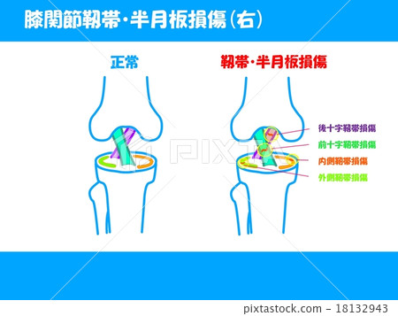 膝關節韌帶·半月板病變 18132943