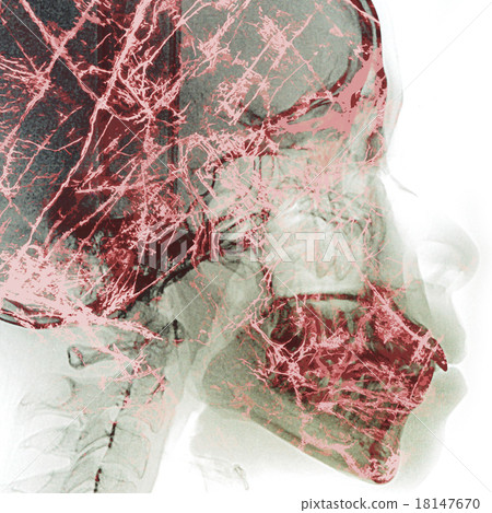 pathogen abstract with x-ray film background on double exposure pathogen abstract with x-ray film background on double exposure 18147670