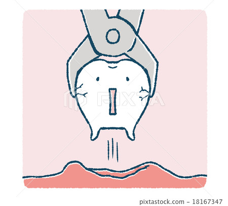 Tooth to be extracted 18167347