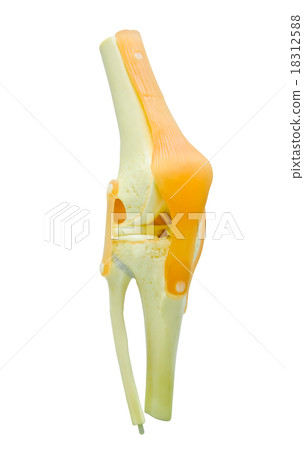 plastic study model of a knee replacement. 18312588