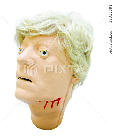 Head injury patients model. Head injury patients model. 18312591