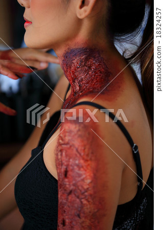 Injured woman in pain 18324257