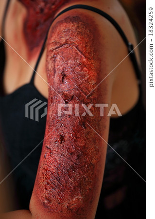 Injured woman in pain Injured woman in pain 18324259