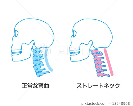 Straight neck - Stock Illustration [18340968] - PIXTA