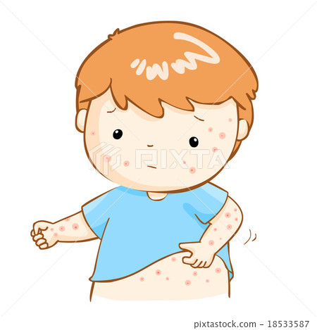 boy scratching itching rash on his body vector 18533587
