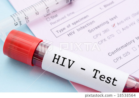Sample blood collection tube with HIV test label Sample blood collection tube with HIV test label 18538564