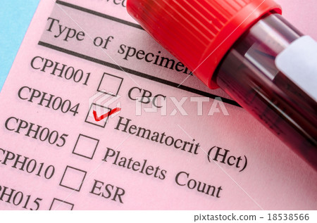 Hematocrit test blood. Hematocrit test blood. 18538566