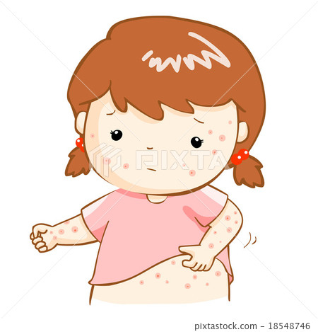 girl scratching itching rash on his body vector 18548746