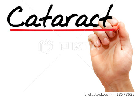 Cataract Cataract 18578623