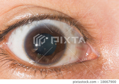 eye exam eye exam 18667900