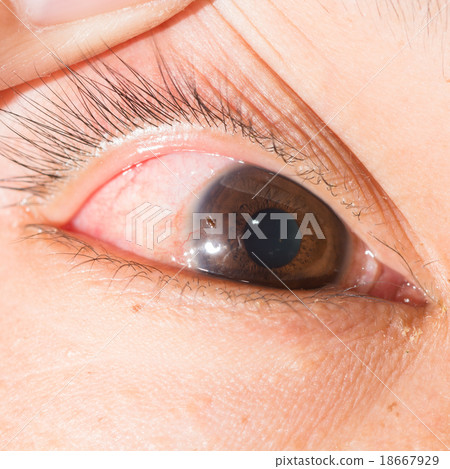 eye exam 18667929